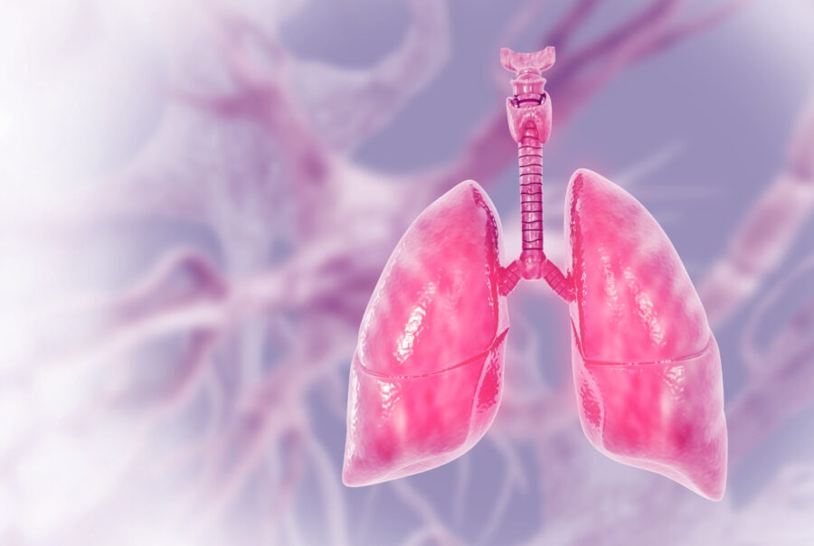 Primer Silyer Diskinezi’de  Fizyoterapi ve Rehabilitasyon